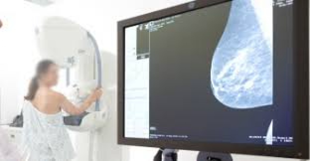 Serviço itinerante de mamografia atende mulheres na Unidade de Saúde Santarém 