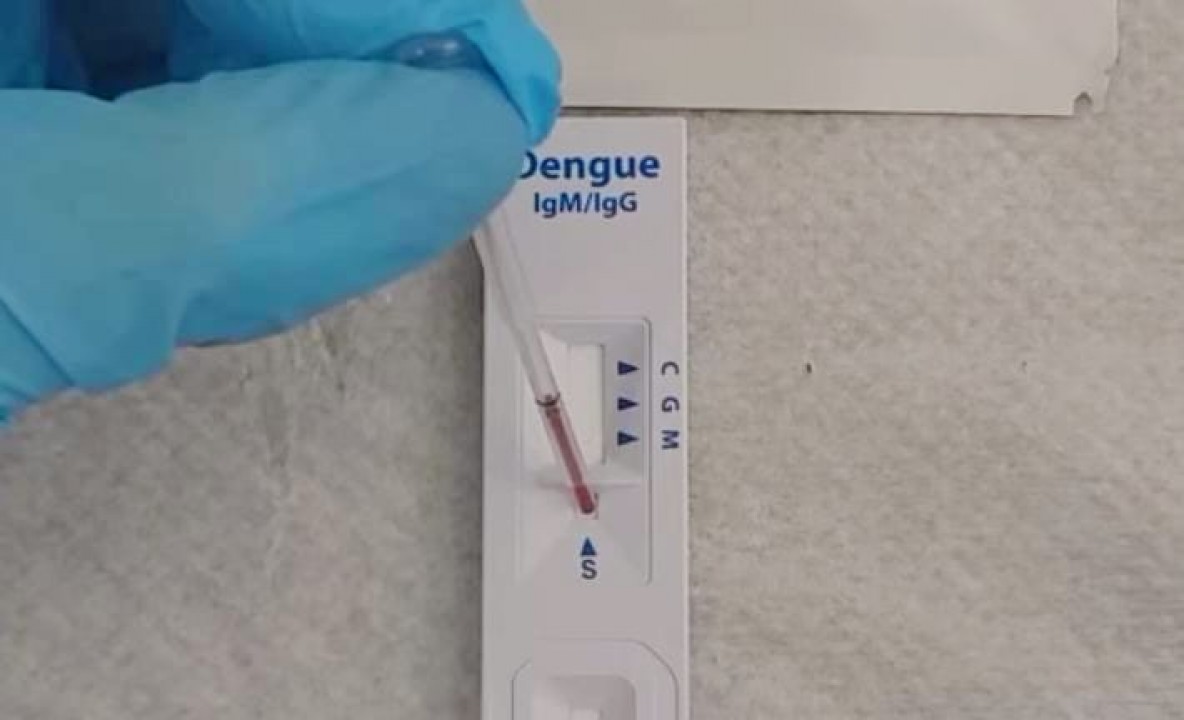 Dengue: Anvisa estuda comercialização de autotestes para o diagnóstico da doença